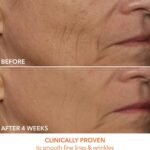 Máscara LED Dr Dennis Gross