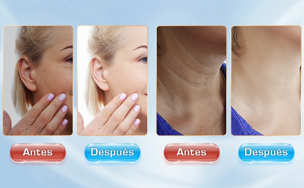 Antes y después masajeador facial Tianyueweilai