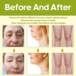 TUMAKOU-Radiofrecuencia