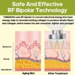TUMAKOU-Radiofrecuencia