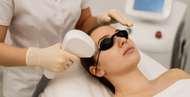 láser facial